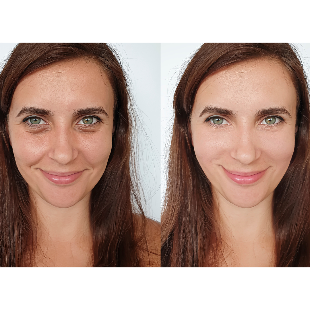 Anti-aging transformation